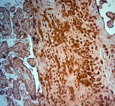 Immunohistochemistry-Paraffin: SRD5A2 Antibody [NBP1-46510]