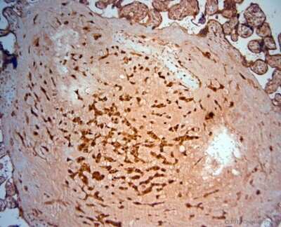 Immunohistochemistry-Paraffin: SRD5A2 Antibody [NBP1-46510]
