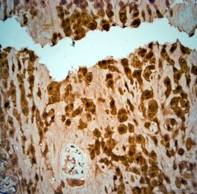 Immunohistochemistry-Paraffin: SRD5A2 Antibody [NBP1-46510]