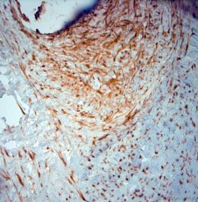Immunohistochemistry-Paraffin: SRD5A2 Antibody [NBP1-46510]