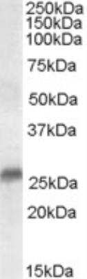 Western Blot: SRD5A2 Antibody [NB300-981]