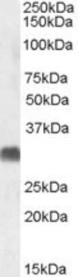 Western Blot: SRD5A2 Antibody [NBP1-36990]