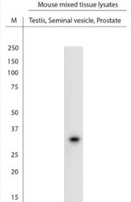 Western Blot: SRD5A2 Antibody [NBP1-46510]