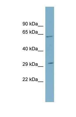 Western Blot: SRD5A2 Antibody [NBP1-69492]