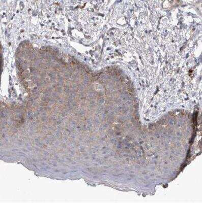 Immunohistochemistry-Paraffin: SRD5A3 Antibody [NBP1-82259]