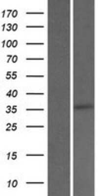 Western Blot: SRD5A3 Overexpression Lysate [NBP2-06316]