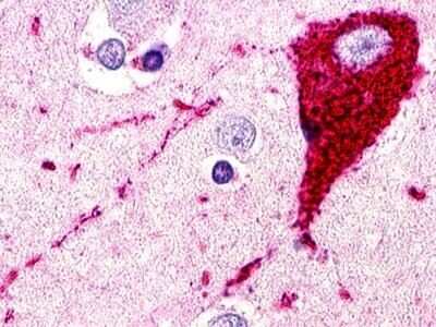 Immunohistochemistry-Paraffin: SREB3 Antibody - BSA Free [NLS516]