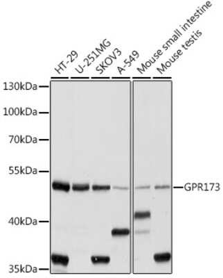 Western Blot: SREB3 AntibodyAzide and BSA Free [NBP2-93961]