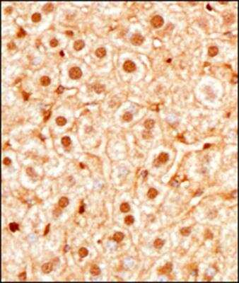 Immunohistochemistry-Paraffin: SREBP1 Antibody - BSA Free [NB100-2215]