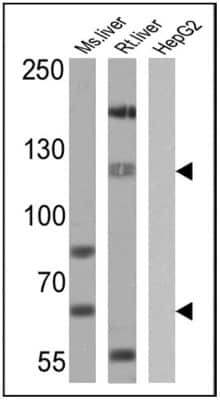 Western Blot: SREBP1 Antibody [NB100-74542]