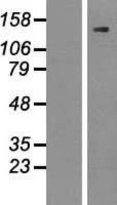 Western Blot: SREBP1 Overexpression Lysate [NBP2-10572]