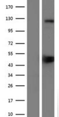 Western Blot: SREBP1 Overexpression Lysate [NBP2-10745]