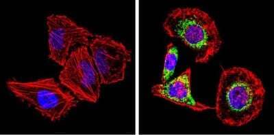 Immunocytochemistry/ Immunofluorescence: SREBP2 Antibody [NB100-74543]