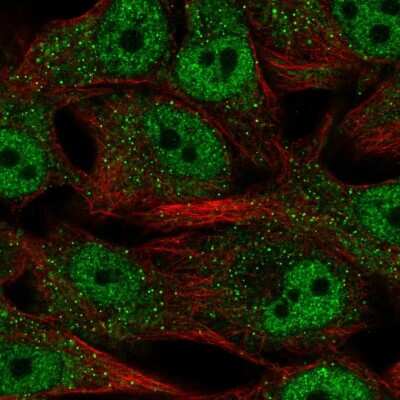 Immunocytochemistry/ Immunofluorescence: SREBP2 Antibody [NBP2-58133]