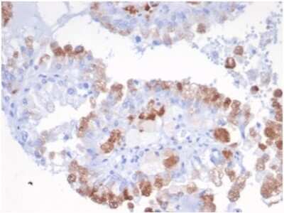 Immunohistochemistry-Paraffin: SREBP2 Antibody (SREBP2/1580) [NBP3-13783]