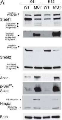 Western Blot: SREBP2 Antibody [NBP1-71880]