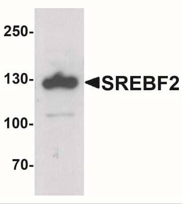 Western Blot: SREBP2 AntibodyBSA Free [NBP2-41282]