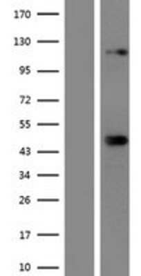 Western Blot: SREBP2 Overexpression Lysate [NBP2-11590]