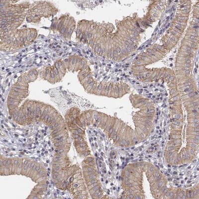 Immunohistochemistry-Paraffin: SREC-I/SCARF1 Antibody [NBP2-57396]