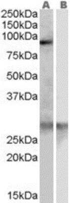 Western Blot: SREC-I/SCARF1 Antibody [NB100-1456]