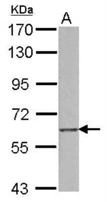 Western Blot: SREC-I/SCARF1 Antibody [NBP2-20266]