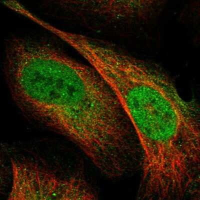 Immunocytochemistry/ Immunofluorescence: SREC-II/SCARF2 Antibody [NBP1-83140]