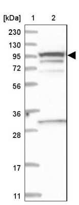 Western Blot: SREC-II/SCARF2 Antibody [NBP1-83140]