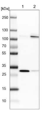 Western Blot: SREC-II/SCARF2 Antibody [NBP1-83140]