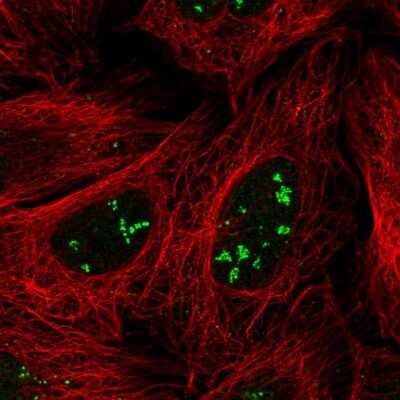 Immunocytochemistry/ Immunofluorescence: SRFBP1 Antibody [NBP2-58809]