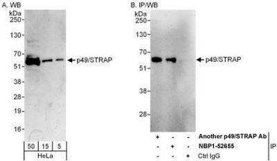 Western Blot: SRFBP1 Antibody [NBP1-52655]