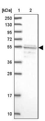 Western Blot: SRFBP1 Antibody [NBP1-88518]