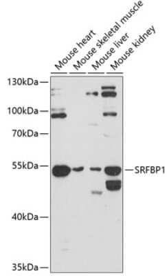 Western Blot: SRFBP1 AntibodyAzide and BSA Free [NBP2-92998]