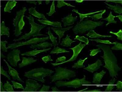 Immunocytochemistry/ Immunofluorescence: SRGAP1 Antibody (5D10) [H00057522-M07]
