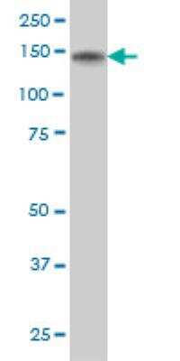 Western Blot: SRGAP1 Antibody (5D2) [H00057522-M03]