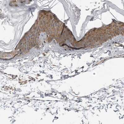 Immunohistochemistry-Paraffin: SRGAP2 Antibody [NBP1-88830]