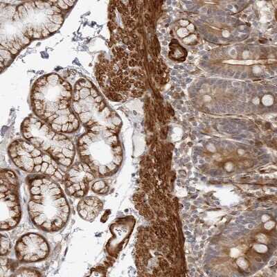Immunohistochemistry-Paraffin: SRGAP2 Antibody [NBP1-88830]