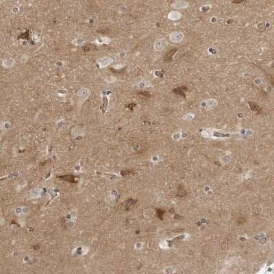 Immunohistochemistry-Paraffin: SRGAP2 Antibody [NBP1-88830]