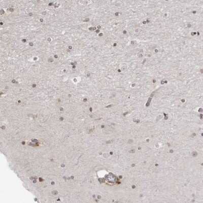 Immunohistochemistry-Paraffin: SRGAP2 Antibody [NBP1-89013]