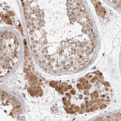 Immunohistochemistry-Paraffin: SRGAP2 Antibody [NBP1-89013]