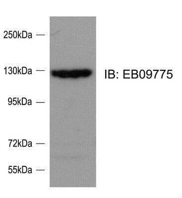 Western Blot: SRGAP2 Antibody [NBP1-49877]