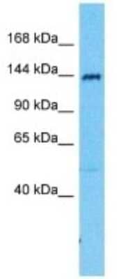 Western Blot: SRGAP2 Antibody [NBP3-09966]