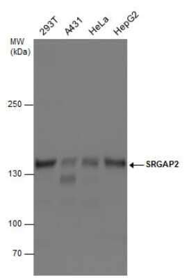 Western Blot: SRGAP2 Antibody [NBP3-12953]