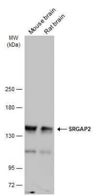 Western Blot: SRGAP2 Antibody [NBP3-12953]