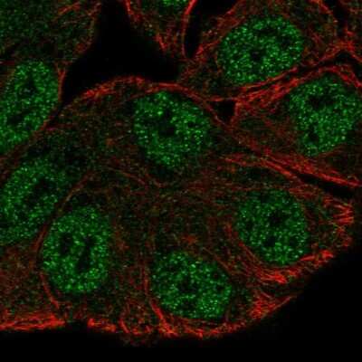 Immunocytochemistry/ Immunofluorescence: SRGAP3 Antibody [NBP2-38521]