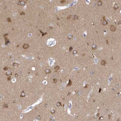 Immunohistochemistry-Paraffin: SRGAP3 Antibody [NBP1-88831]