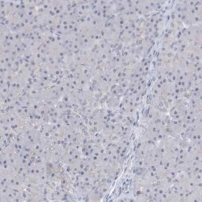 Immunohistochemistry-Paraffin: SRGAP3 Antibody [NBP1-88831]