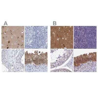 Immunohistochemistry-Paraffin: SRGAP3 Antibody [NBP1-88831]