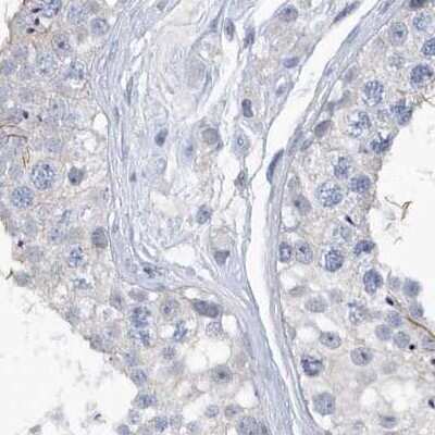 Immunohistochemistry-Paraffin: SRGAP3 Antibody [NBP1-88831]