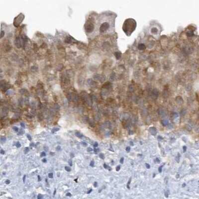 Immunohistochemistry-Paraffin: SRGAP3 Antibody [NBP1-88831]
