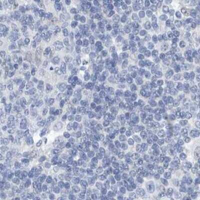 Immunohistochemistry-Paraffin: SRGAP3 Antibody [NBP1-88831]